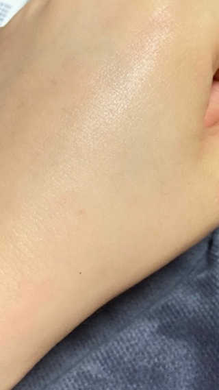 보나셀라 진정크림 + 미백앰플 2종 세트 — 4.5점을 준 리뷰어가 2020년 12월 올린 사용 사진