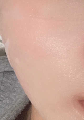 로벡틴 닥터 마스크 아쿠아 — 5점을 준 리뷰어가 2020년 4월 올린 사용 사진
