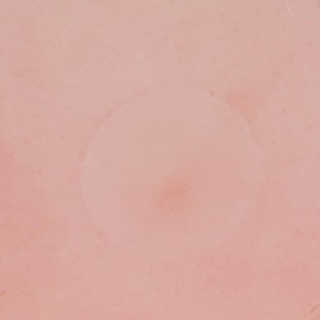 엘라밴드 하이드로 도트 스팟패치 12mm, 10mm — 5점을 준 리뷰어가 2020년 8월 올린 사용 사진