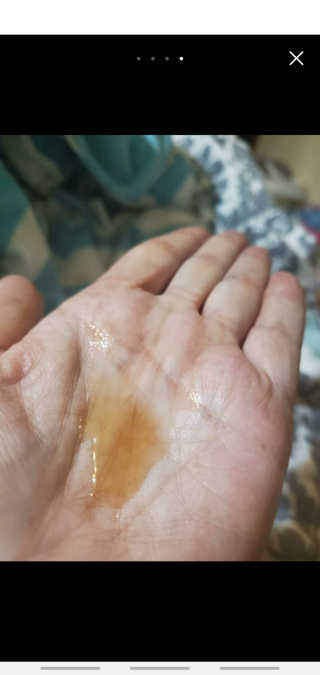 VELY VELY Artemisia Balance Essence — 5점을 준 리뷰어가 2020년 8월 올린 사용 사진