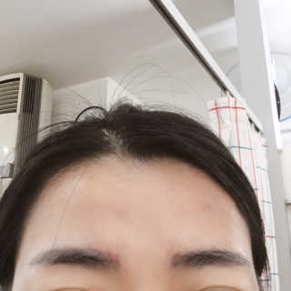 다슈코리아 다슈 데일리 탈모완화 초강력 헤어 스프레이 — 5점을 준 리뷰어가 2020년 9월 올린 사용 사진