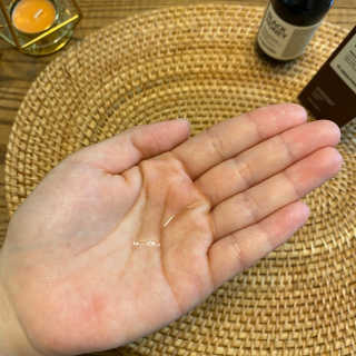 메디필 블랙 허니 세범 익스트렉터 — 5점을 준 리뷰어가 2020년 6월 올린 사용 사진