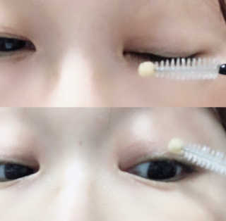 닥터존스킨 눈썹자라 — 4.5점을 준 리뷰어가 2020년 8월 올린 사용 사진
