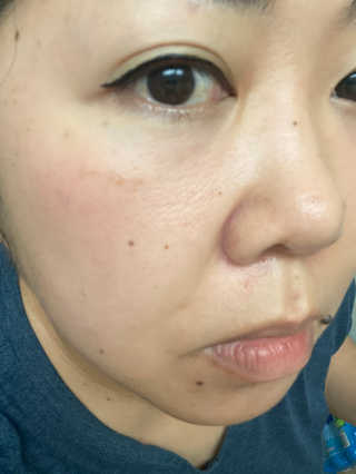 Emogurloveskincare님이 올린 리뷰 사진 3