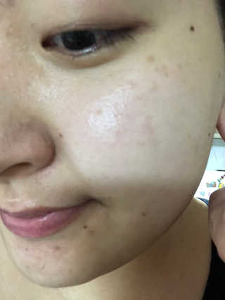 [미릴] 맑음빛 레드빈 브라이트닝 앰플 — 5점을 준 리뷰어가 2020년 11월 올린 사용 사진