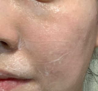 더말로지카 울트라 카밍 클렌저 — 5점을 준 리뷰어가 2020년 7월 올린 사용 사진