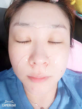 아이디플라코스메틱 아이디 페이스핏 마이너스 밴드 — 2점을 준 리뷰어가 2020년 4월 올린 사용 사진
