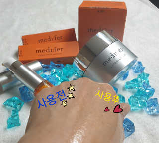 메디페르 [ 2+1 ] 루테인앰플 10ml 2개 + 루테인크림 50ml 1개 — 5점을 준 리뷰어가 2020년 7월 올린 사용 사진