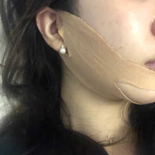 아이디플라코스메틱 아이디 페이스핏 마이너스 밴드 — 5점을 준 리뷰어가 2020년 5월 올린 사용 사진