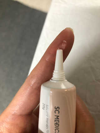 derma SC-Gel 더마에스씨 겔 20g — 4점을 준 리뷰어가 2020년 4월 올린 사용 사진
