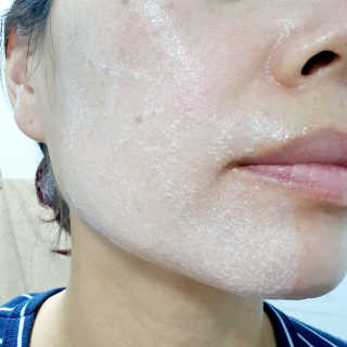 이엘티 비타 하이드로 딥 클렌징 오일 — 5점을 준 리뷰어가 2020년 8월 올린 사용 사진