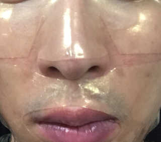 가하코스 클래시 골드겔 마스크 5매 — 5점을 준 리뷰어가 2020년 6월 올린 사용 사진