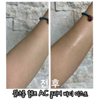 [후르디아] 문제적 바디 피부 케어_왓츠롱 2종 세트 — 5점을 준 리뷰어가 2020년 5월 올린 사용 사진