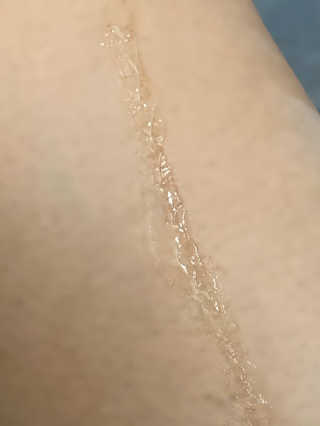 derma SC-Gel 더마에스씨 겔 20g — 4점을 준 리뷰어가 2020년 4월 올린 사용 사진