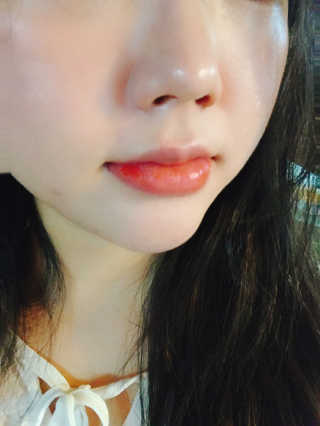 바베 BABE 바베 프로테오글리칸 F+F 앰플 솔루션 — 5점을 준 리뷰어가 2020년 7월 올린 사용 사진