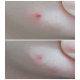 💟봉달💟님이 올린 리뷰 사진 4
