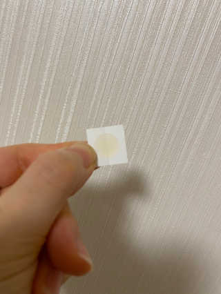 엘라밴드 하이드로 도트 스팟패치 12mm, 10mm — 5점을 준 리뷰어가 2020년 10월 올린 사용 사진