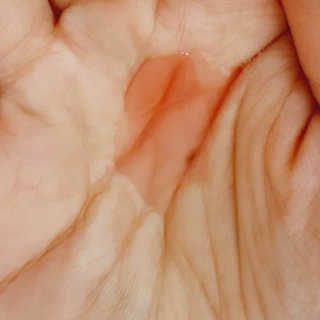 어글리프루프 에센스 스탑디어글리 레드모먼트 에센스 120ml — 4점을 준 리뷰어가 2020년 10월 올린 사용 사진