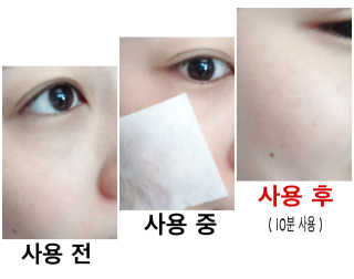 뷰니오 더마플러스 카밍 에멀전200ml — 5점을 준 리뷰어가 2020년 12월 올린 사용 사진