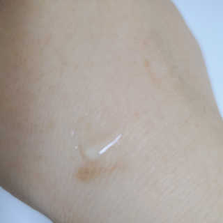 derma SC-Gel 더마에스씨 겔 20g — 5점을 준 리뷰어가 2020년 5월 올린 사용 사진
