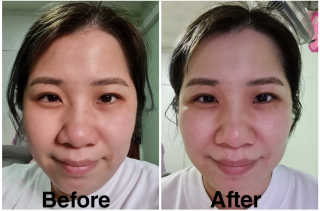 트리티스 [Treatis] Facial Sheet Mask — 5점을 준 리뷰어가 2020년 11월 올린 사용 사진