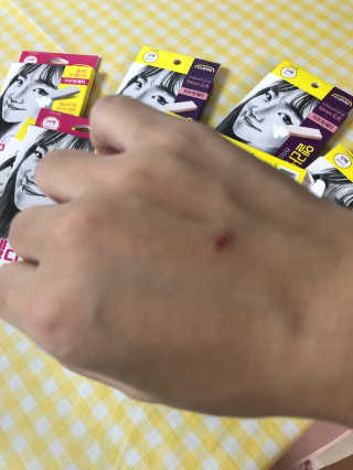 엘라밴드 하이드로 도트 스팟패치 12mm, 10mm — 3점을 준 리뷰어가 2020년 11월 올린 사용 사진