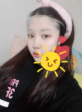 리더스코스메틱 리더스 메디유 아미노 모이스처 마스크 — 4점을 준 리뷰어가 2020년 5월 올린 사용 사진