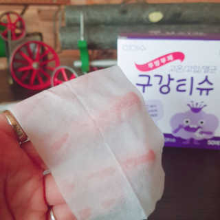 100도 이상에서 삶아 멸균 안심 아이수 구강 티슈 — 5점을 준 리뷰어가 2020년 10월 올린 사용 사진