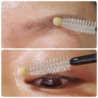 닥터존스킨 눈썹자라 — 5점을 준 리뷰어가 2020년 8월 올린 사용 사진