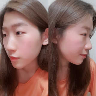 세렌디뷰티 레드 프로폴리스 트리플 앰플 — 5점을 준 리뷰어가 2020년 7월 올린 사용 사진