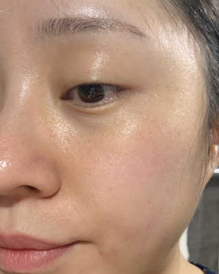 어글리프루프 에센스 스탑디어글리 레드모먼트 에센스 120ml — 5점을 준 리뷰어가 2020년 11월 올린 사용 사진