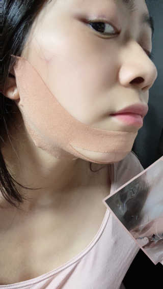 아이디플라코스메틱 아이디 페이스핏 마이너스 밴드 v2 — 4.5점을 준 리뷰어가 2020년 12월 올린 사용 사진