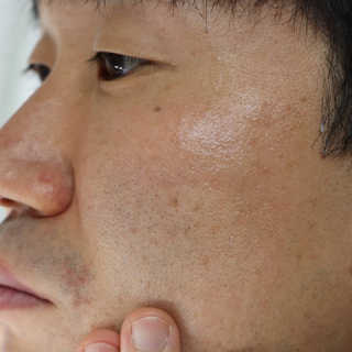 닥터뉴엘 옴므 토탈솔루션 — 5점을 준 리뷰어가 2020년 11월 올린 사용 사진