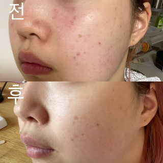 찌니곤듀님이 올린 리뷰 사진 4