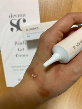 derma SC-Gel 더마에스씨 겔 20g — 5점을 준 리뷰어가 2020년 5월 올린 사용 사진