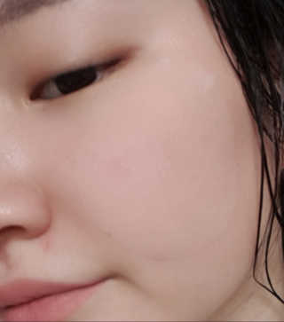 자이엘 S.O.S 레드 칙 케어팩 2 Box — 5점을 준 리뷰어가 2020년 4월 올린 사용 사진