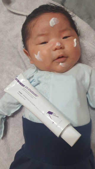 아토스탠다드 베이비크림 — 5점을 준 리뷰어가 2020년 11월 올린 사용 사진