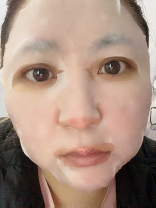 큐템 레이저 마스크 — 4점을 준 리뷰어가 2020년 11월 올린 사용 사진