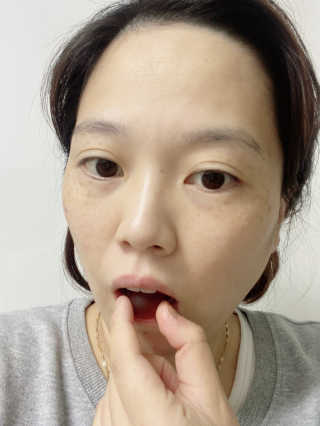니몸내몸 영양젤리 3종 중 택1 — 5점을 준 리뷰어가 2020년 11월 올린 사용 사진