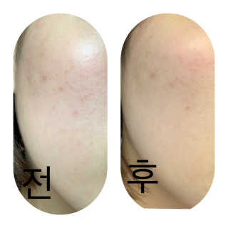 Dr다룸 릴리프 앰플 — 4점을 준 리뷰어가 2020년 5월 올린 사용 사진