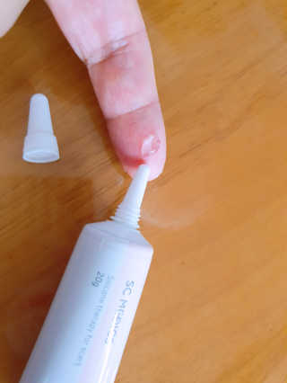 derma SC-Gel 더마에스씨 겔 20g — 5점을 준 리뷰어가 2020년 5월 올린 사용 사진