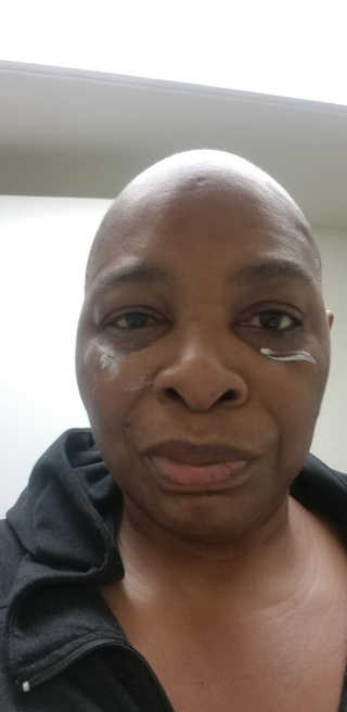 TZ 펩 타는 모든 얼굴 눈동자에 영향을 미칩니다 — 4.5점을 준 리뷰어가 2020년 4월 올린 사용 사진