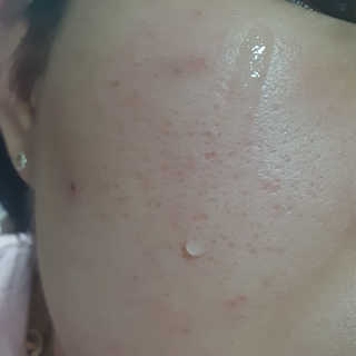 [스킨큐어] 산다화 비타민C 화이트닝 에센스 30ml — 3점을 준 리뷰어가 2020년 4월 올린 사용 사진