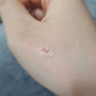 derma SC-Gel 더마에스씨 겔 20g — 5점을 준 리뷰어가 2020년 4월 올린 사용 사진