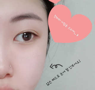 자이엘 S.O.S 레드 칙 케어팩 2 Box — 5점을 준 리뷰어가 2020년 4월 올린 사용 사진