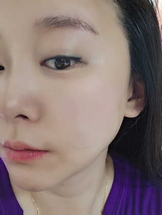 자이엘 S.O.S 레드 칙 케어팩 2 Box — 5점을 준 리뷰어가 2020년 4월 올린 사용 사진