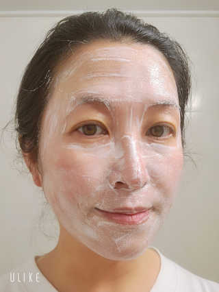 메디필 에스테 더마 유산균 콜라겐 클리어 — 4점을 준 리뷰어가 2020년 5월 올린 사용 사진