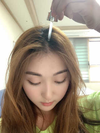 [루토닉스] 루트팜 에너지 볼륨 앰플 35ml — 5점을 준 리뷰어가 2020년 10월 올린 사용 사진