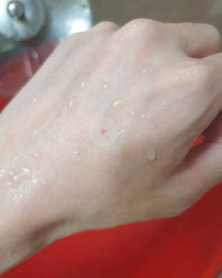 엘라밴드 하이드로 도트 스팟패치 12mm, 10mm, 티트리 — 5점을 준 리뷰어가 2020년 9월 올린 사용 사진
