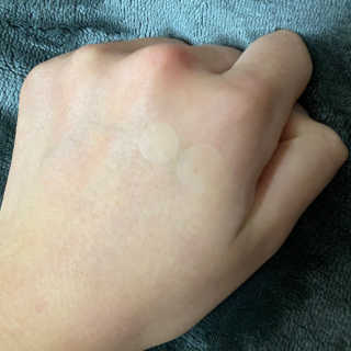 엘라밴드 하이드로 도트 스팟패치 12mm, 10mm — 5점을 준 리뷰어가 2020년 10월 올린 사용 사진